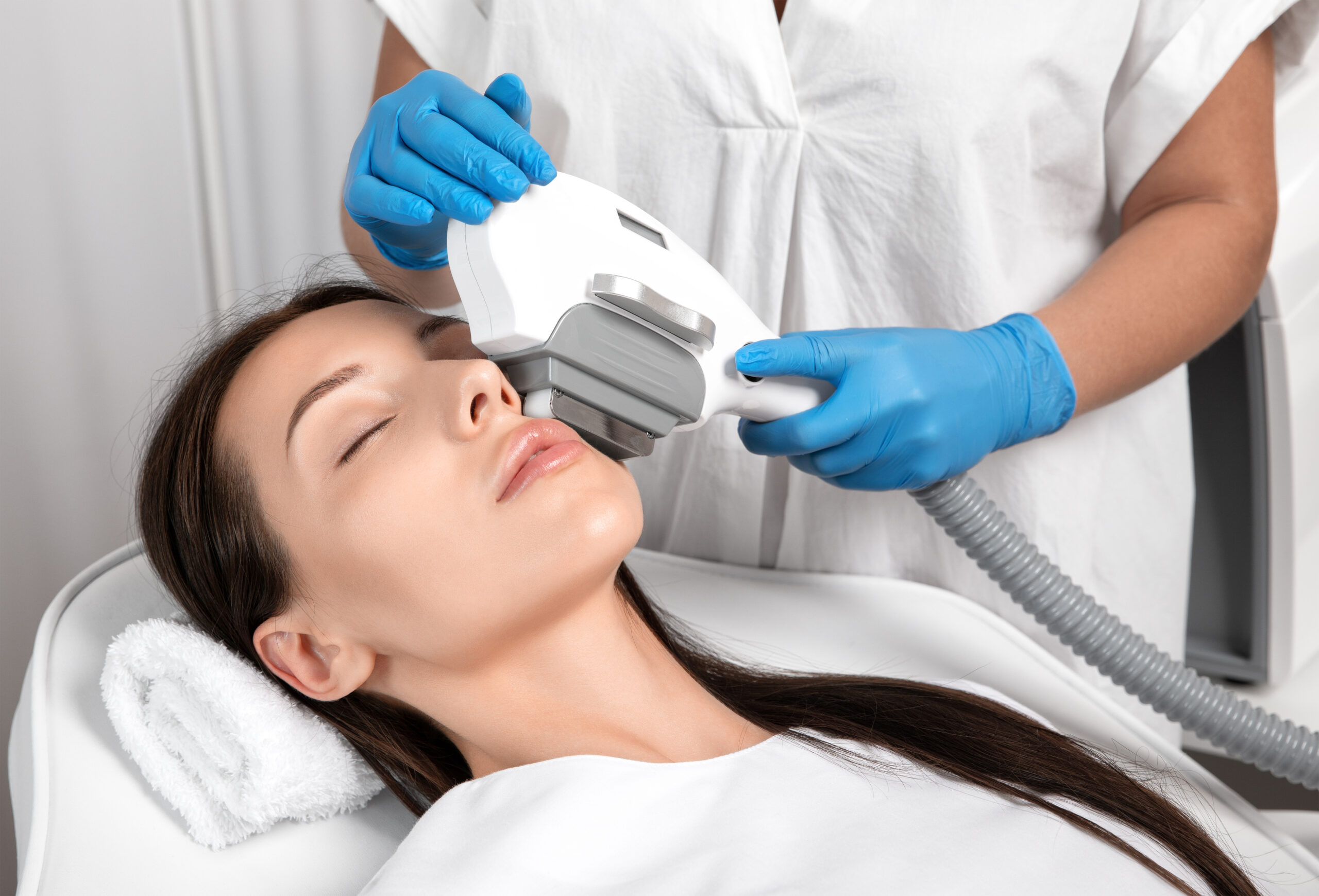Elos,Epilation,Hair,Removal,Procedure,On,The,Face,Of,A PBserum medium segunda generación - Imagen 1